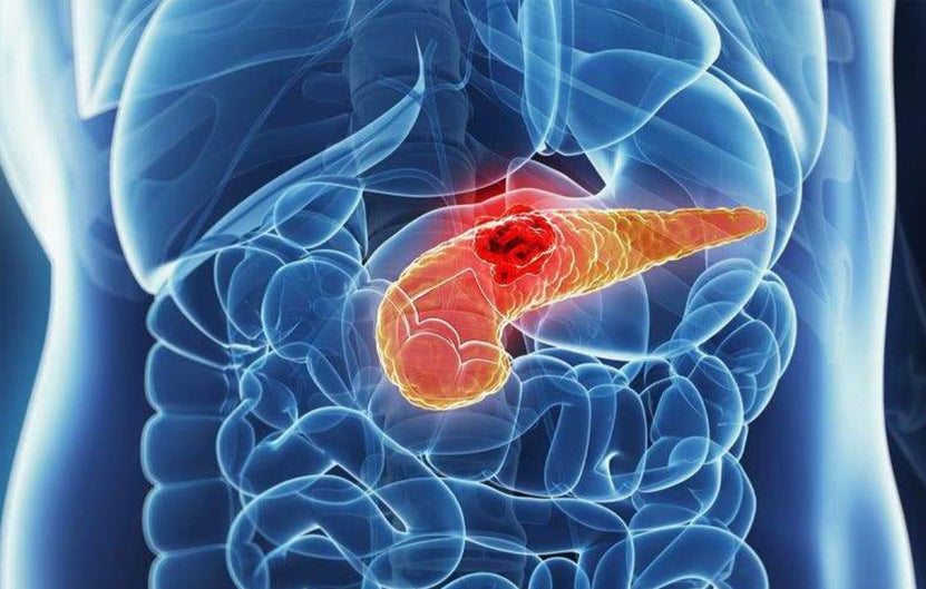 Gallbladder Polyp Found on Exam: Is Surgery the Only Option?