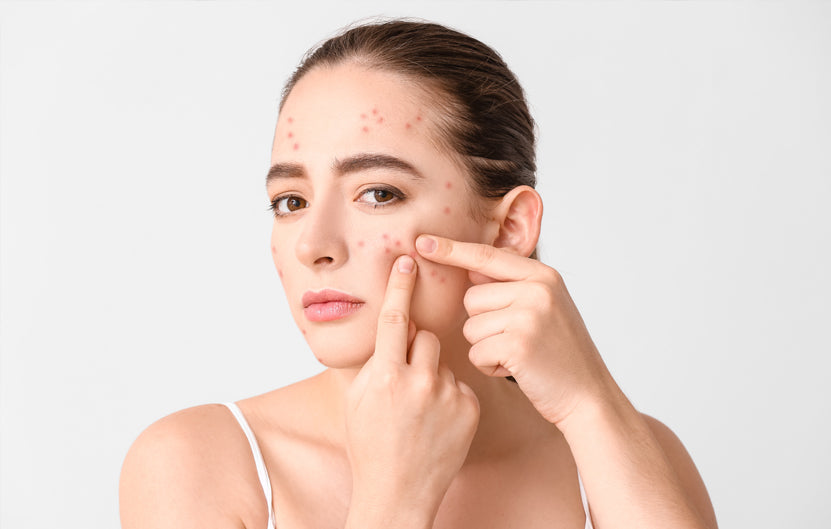 Spring Skin Allergies: How to Stay Away From Redness, Itching, and Swelling